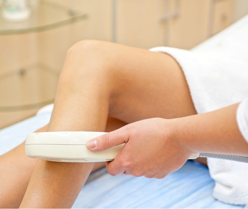 Depilacion laser contraindicada con vitiligo y psoriasis