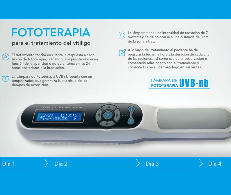 Fototerapia para el tratamiento del vitíligo