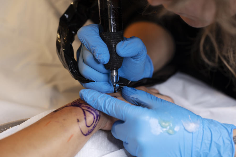 Vitíligo y tatuajes