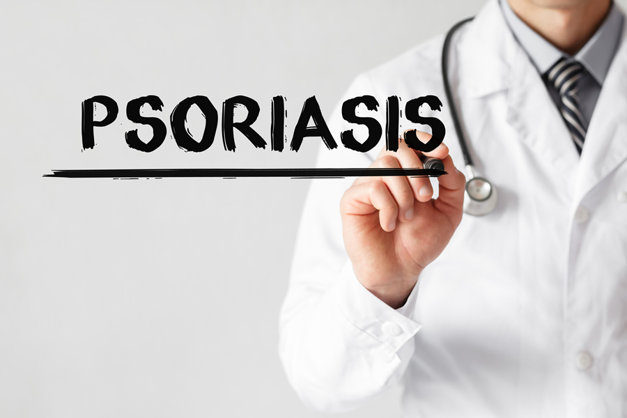 tratamiento de la psoriasis
